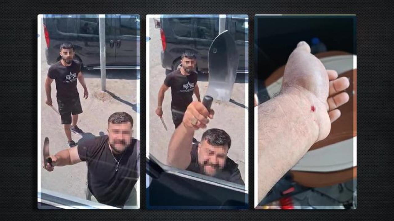 Yer: Hatay! Yol verme kavgasında satırla saldırdı... Öldüremeyince yaraladı!