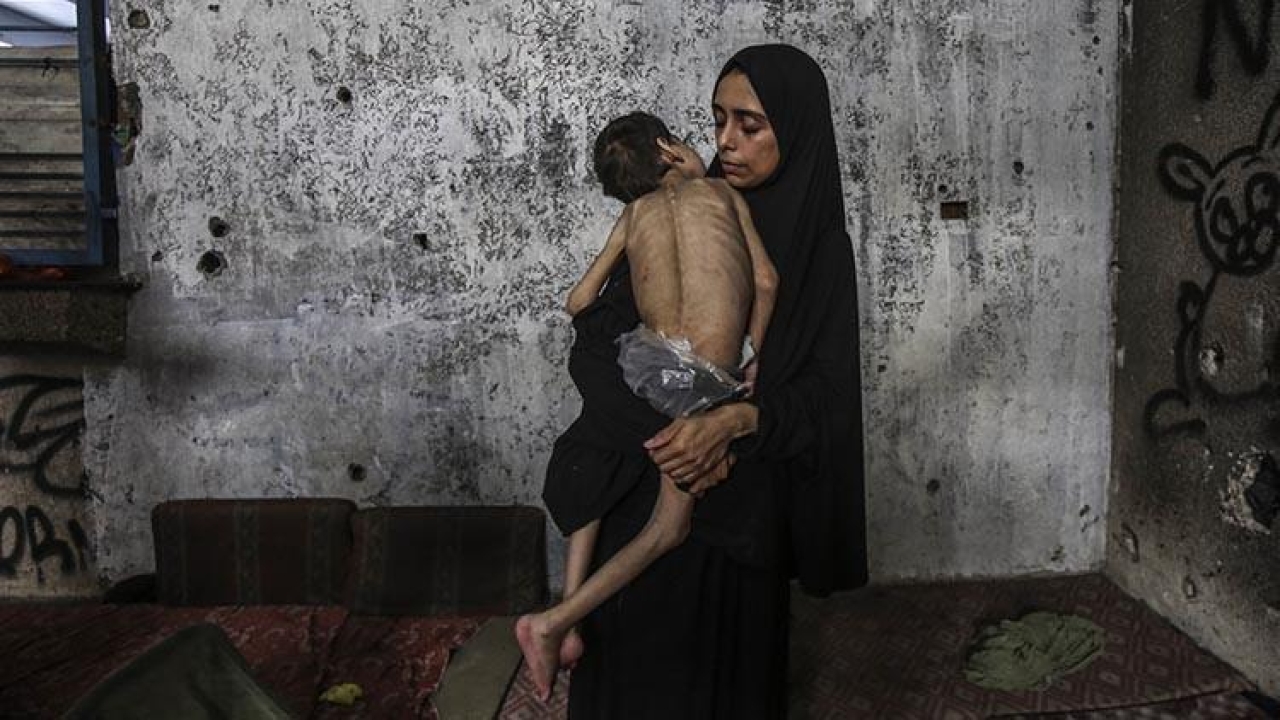 Gazze'de açlık krizi büyüyor: Ölenlerin sayısı 127'ye yükseldi