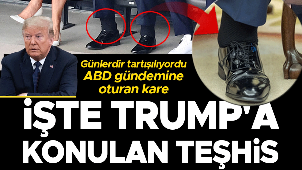 Günlerdir tartışılıyordu: ABD'nin gündemine oturan kare! İşte Trump'a konulan teşhis