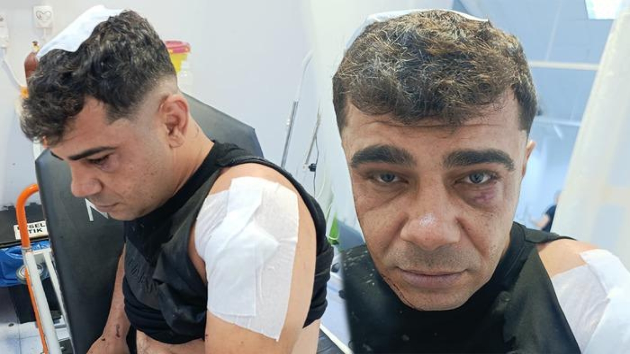 İş görüşmesi için gitti, ölümden döndü! "Olay yerinde hayatımı kaybedebilirdim"