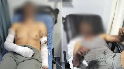 Manisa'da oto tamirhanesinde patlama: 2 kişi ölümden döndü