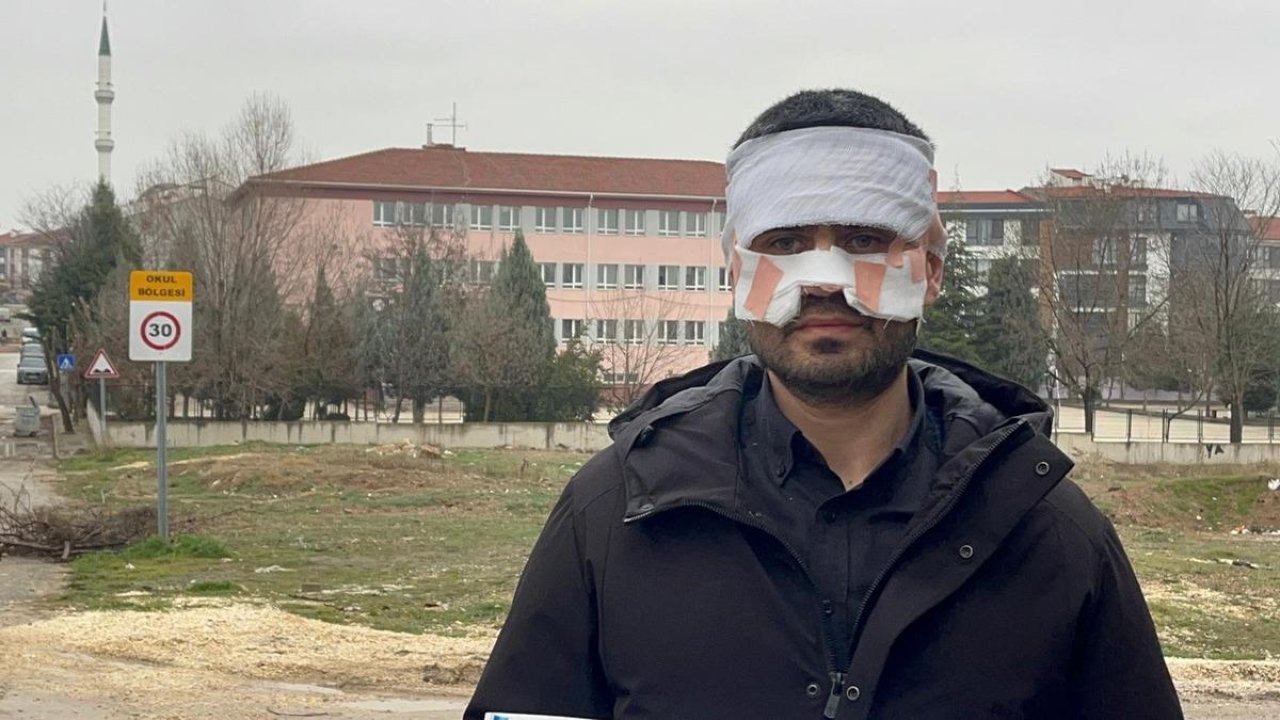 Öğretmen öğretmene bunu yapar mı? Bu kadarına pes: Kaynar çayı yüzüne fırlatıp...